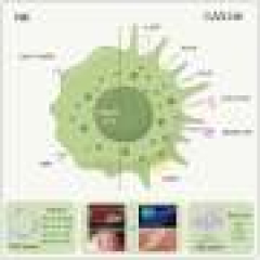 Universal stem cells reset immunity in a systemic sclerosis patient