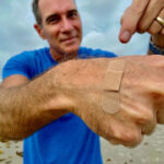 Deadly ‘flesh-eating bacteria’ can thrive at the beach. How to stay safe.