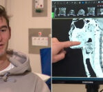 Robotic surgery at St Vincent’s Hospital saves Melbourne man’s voice and ability to eat