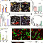 Estrogen-regulated renal progenitors determine pregnancy adaptation and preeclampsia | Science