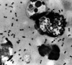 Arizona resident dies from plague, health officials say