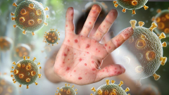 Measles alert issued for Gold Coast school and bus routes after confirmed case