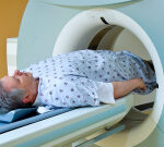 Can PSMA PET/CT Improve Prostate Cancer Staging and Care?
