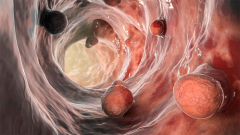 Faecal Biomarker May Reduce Child Colonoscopy Need