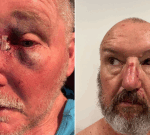 NSW prison officers walk off job after inmate avoids jail for brutal attack