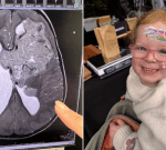 Proton beam therapy: Australians still waiting a decade after SA vision for ‘future of cancer care’