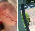 Teen struck by car on wrong side of the road in Mandurah, WA