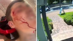 Teen struck by car on wrong side of the road in Mandurah, WA