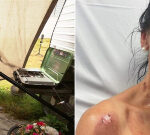 Redcliffe mother Rachel Dear seriously injured as Christmas roast explodes into fireball