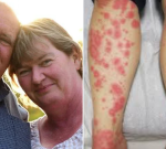 Mother-of-10 airlifted to Sydney intensive care after rare antibiotic reaction