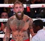 Paul has titanium plates fitted after Joshua breaks jaw