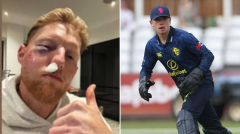 Ben Stokes’ classy act immediately after suffering brutal face injuries in freak training accident