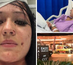Sister of Zoe Samson-Wood details horrific nature of her injuries following stabbing attack at Easts Leagues Club in Coorparoo