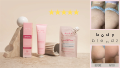 Shoppers are obsessed with this miracle cellulite and stretch mark lotion