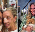 Women brutally attacked by disgraced Sydney dentist who was shot dead by police in Potts Point reveal injuries